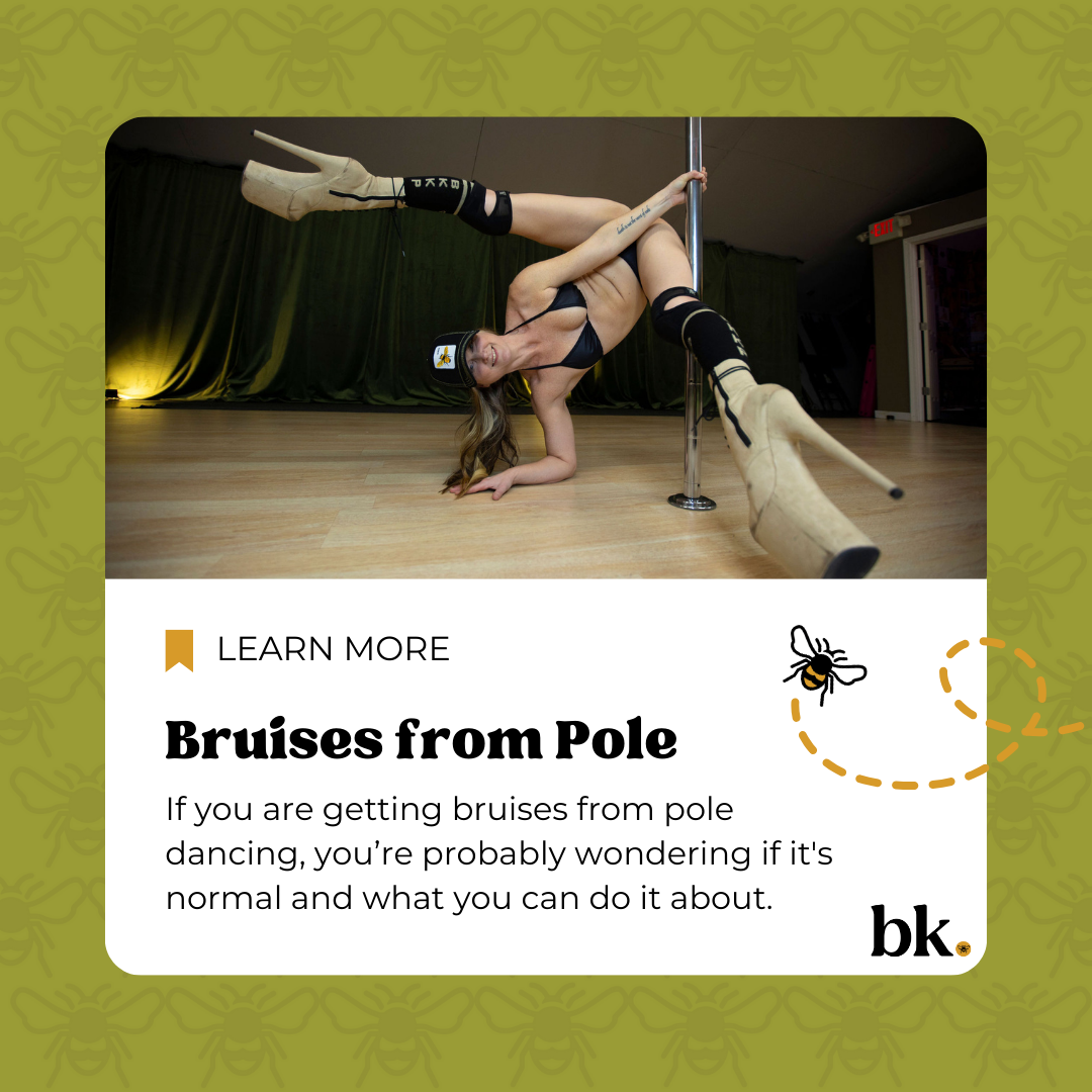 Help! I have bruises from pole dancing!